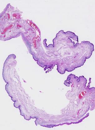 5. Patologins nuläge, framtid och utmaningar 5.1 Introduktion till klinisk patologi Patologi är läran om sjukdomar, deras orsaker, inbördes samband och hur de diagnostiseras.