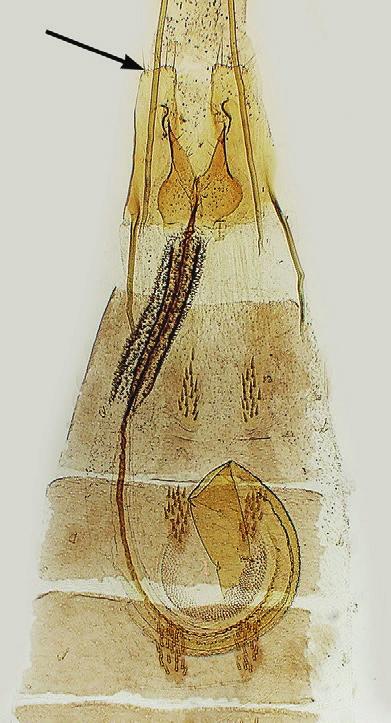 Important features are indicated with arrows: a large spine on the posterior phalloteca arm and a smaller one at the base of the anterior arm. b) Male genitalia of C. virgaureae (Stt.). Gen. prep.