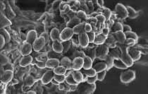 Mjältbrandsbakterien Bacillus anthracis kan bland annat i kontakt med luft bilda mycket motståndskraftiga sporer.