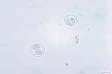 HISTORIK Toxoplasma gondii upptäcktes 1907 och fick sitt namn efter sin morfologi (toxo = båge och plasma = liv) och gnagararten gundi, från vilken T gondii först isolerades i samband med forskning