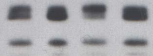 Bim XL Bim L C A C* A* Figure.14 Western blot analysis showed the expression of Bim protein after 24 h of activation.