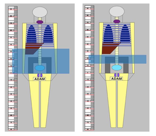 3.7.2 CT-Expo To calculate the effective doses from the CT scans, CT-Expo v2.5 was used. In the calculations, the weighting factors from ICRP 103 was used.