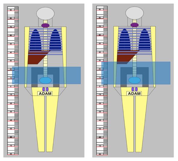 The DICOM data were retrieved using Micro Dicom viewer and to collect values from specific DICOM tags a homemade program, Tagga Ner, was used.