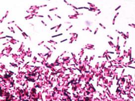 Smittämne Miljöbakterie som bildar sporer och toxin Sporer överlever i månader år Toxin orsakar inflammation, diarré (toxin A