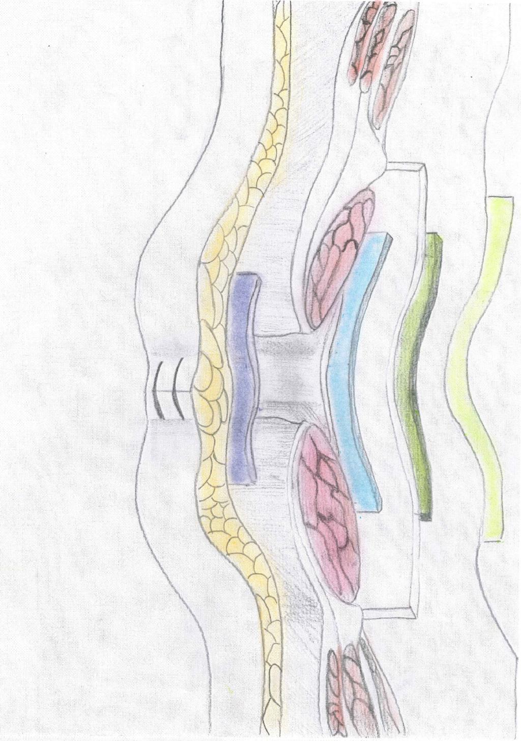 Aspects on colostomy construction, complications and stoma function stoma 28. However, there are some cases where fatty and shortened mesentery or bowel conditions make this step somehow difficult 29.
