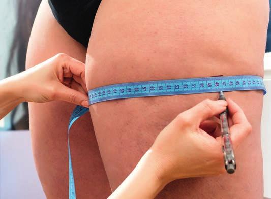 Många försök har därefter gjorts, men med dåliga och oförutsägbara resultat på grund av absorption av fettet och fibrosbildning.