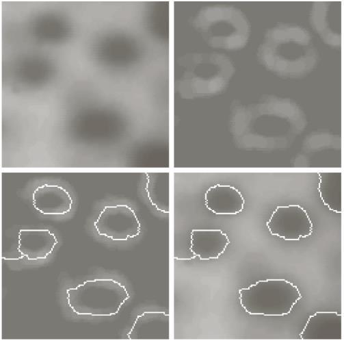 Wtershed segmentering, Ex 1) Wtershed segmentering, dmmkonstruktion ) 1: diltion d (8) = : diltion dmmvll b) c) 3:e diltion Fig. 1.55 Wtershed segmenttion, dm construction Let C n-1 (M 1 ) denote the pixels in lke M 1 t flooding step n-1.