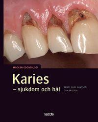 Karies : sjukdom och hål PDF LÄSA ladda ner LADDA NER LÄSA Beskrivning Författare: Bengt Olof Hansson. Hål i tänderna har de flesta en uppfattning om vad det är, men vad betyder karies som sjukdom?
