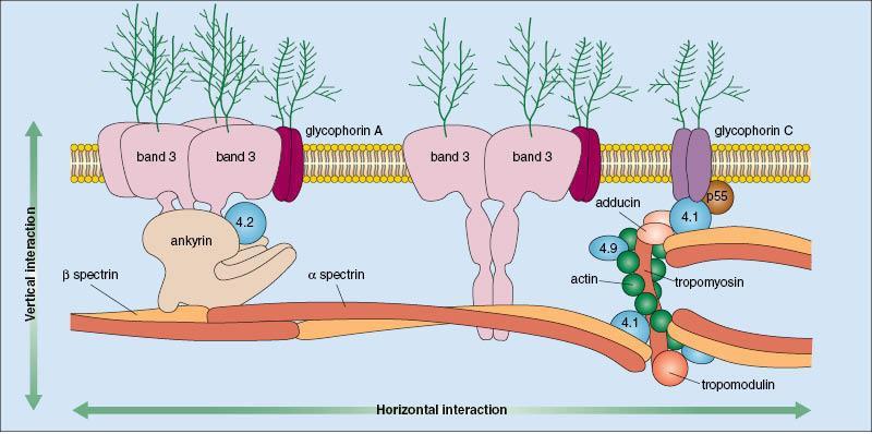 Andra membranopatier Hereditär sfärocytos orsakas av defekter i den vertikala interaktionen