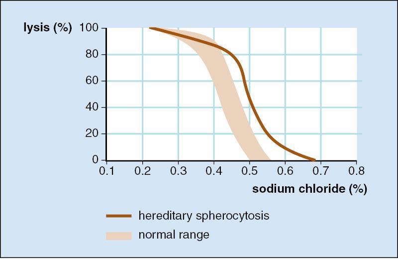 Osmotisk fragilitet (OF) sfärocyter lyserar snabbare än normala erytrocyter i hypoton saltlösning rekommenderas inte som enskilt test för hereditär sfärocytos på grund av låg