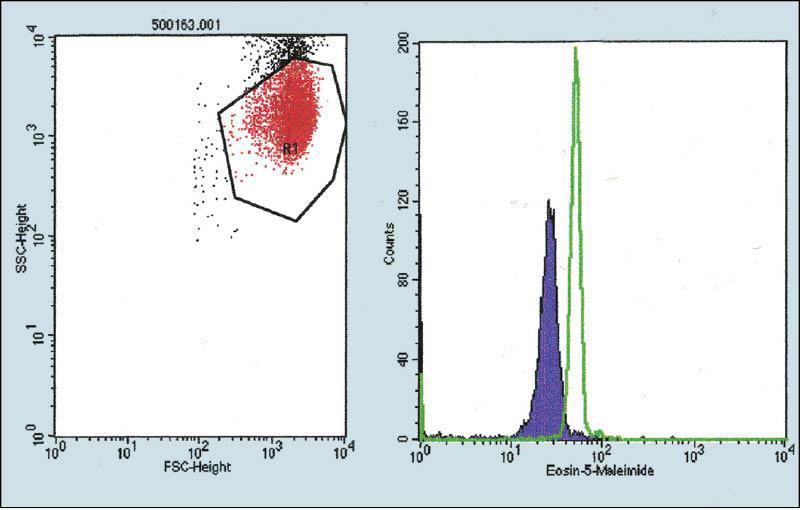 Eosin-5-maleimid- (EMA) bindningstest ( Band3 ) EMA binder till band 3 protein som återfinns i lägre halt i erytrocytens membran vid HS.