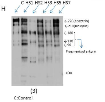 Analys av membranproteiner (SDS-PAGE) Analys av membranproteiner (SDS-PAGE) rekommenderas vid negativa eller tvetydiga