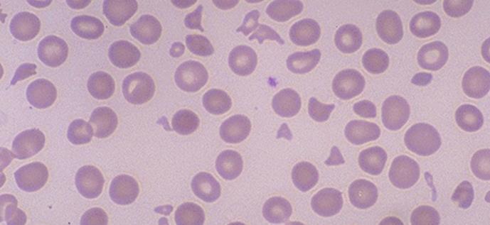 till spektrin Cellmembranet frikopplas från cytoskelettet och