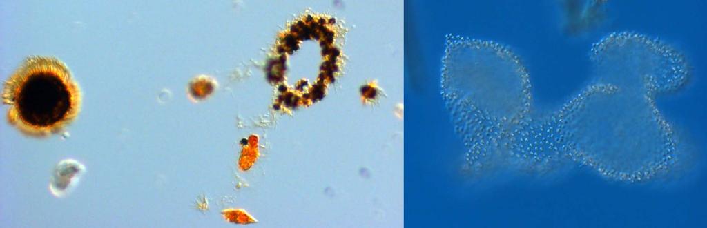 The Baltic Sea BY2 Arkona 27 th of April and BY5 Bornholms basin 27 th of April These two stations were dominated by a 1 µm small unicell and the unidentified flagellate was at both stations.
