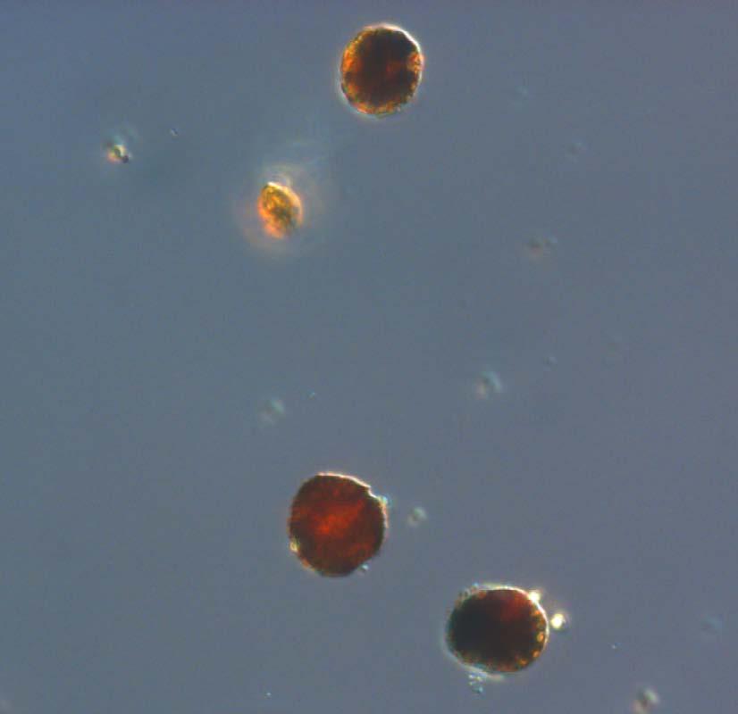 A phytoplankton sample from a fluorescence maximum at 20 meters depth was dominated by the unidentified flagellate. Plankton community with a cyanobacterial colony at Bornholms basin.