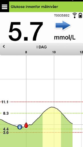 Disse glukoseverdiene blir så beregnet av Smart-senderen, og sendt til appen. Eversense XL Sensor varer i opptil 180 dager.
