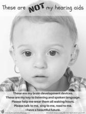 ..men konkrrerar också kognitiv tveckling, mentaliserings förmåga Hörseltveckling Vid mitten av graviditeten är örat färdigtvecklat - fostret börjar höra De centrala hörselbanorna och hörselbarken