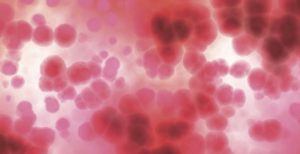 Vid ALL heter de sjuka leukemicellerna lymfoblaster. Normalt skulle lymfoblasterna stegvis utvecklas till mogna vita blodkroppar av typen lymfocyter.
