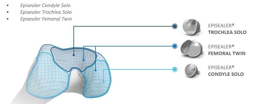 Episealer för knän finns i tre produktlinjer: Episealer Condyle Solo, Episealer Trochlea Solo och Episealer Femoral Twin. Vilken Episealer som passar bäst beror på vart i knät skadan sitter.