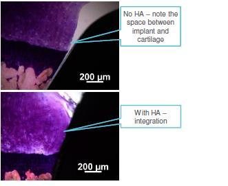 Hydroxylapatits betydelse för stabilitet och infästning Två histologiska bilder där den övre bilden visar ett tydligt glapp mellan implantat och omgivande brosk och där hydroxylapatit (HA) inte har