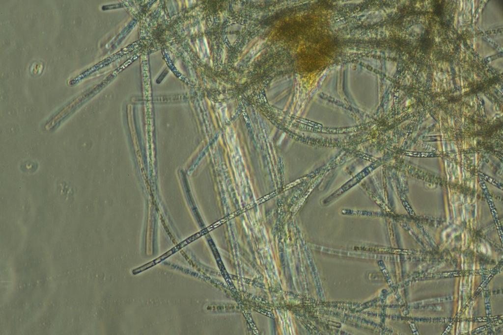 The bloom was dominated by the cyanobacterium Aphanizomenon yezoense!