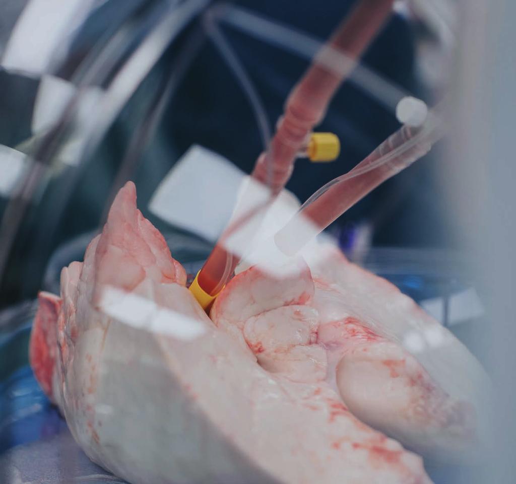 DELÅRSRAPPORT JANUARI-MARS 2019 XVIVO PERFUSION AB (PUBL) XVIVO Perfusion är ett medicinteknikbolag som utvecklar och marknadsför lösningar och system för att bedöma användbarhet, möjliggöra