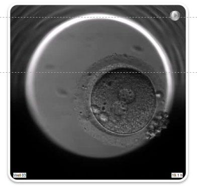 FÖRBÄTTRAT RESULTAT GENOM ANVÄNDNING AV TIME-LAPSE Genom att ta upprepade bilder av ett embryo skapas en video som visar utvecklingen Artificiell intelligens / deep learning algoritmer för att skapa