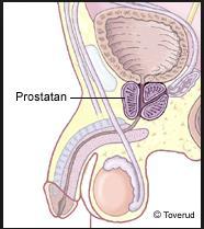 Prostatit Noggrann och grundlig information