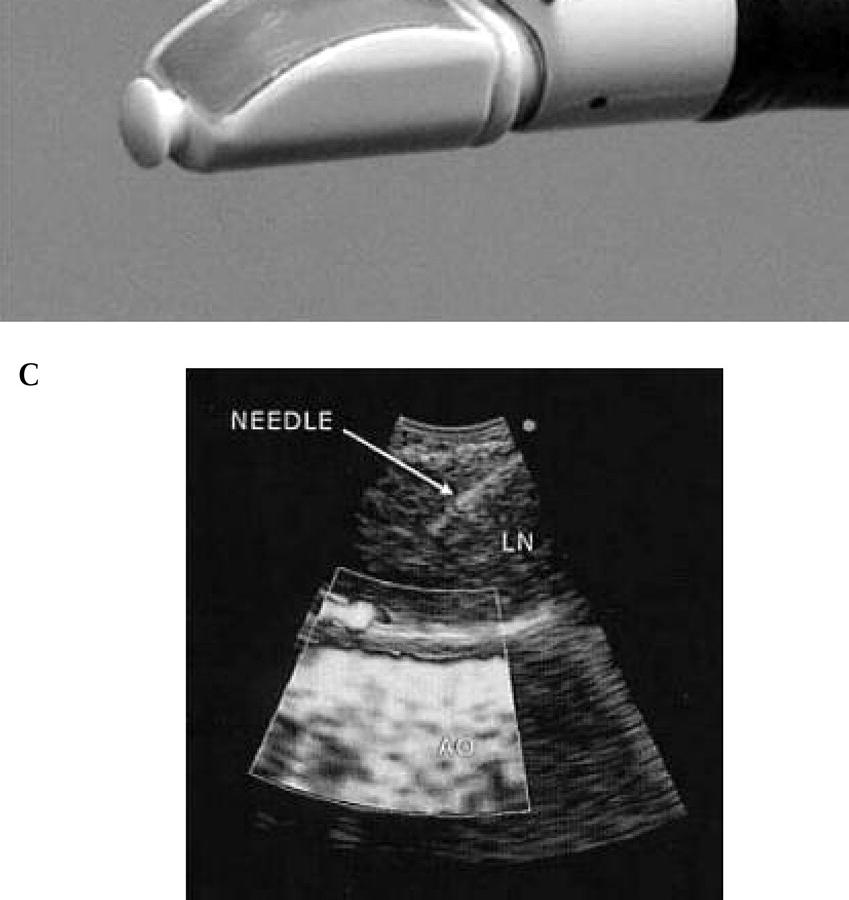 generell anestesi Provtagningsordning N3 N2 N1. Endobronkiella prover.