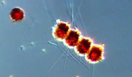 2: Remnants of a diatom bloom in the Arkona Basin where the diatoms Skeletonema marinoi and Chaetocerous similis were found in relatively high cell numbers.