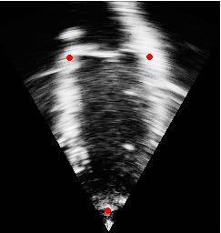 3 PRESENTATION OF THE PROBLEM The research assignment was to develop an algorithm that can automatically find the co-ordinates of certain points in the heart wall in an ultrasound image.