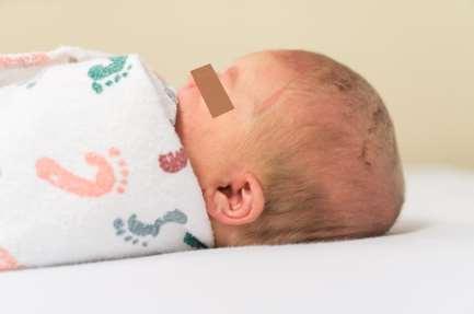 Photograph 1. Contact force from firm surface causes occipital flattening in supine lying infant. Signed parental consent to publish photograph has been obtained.