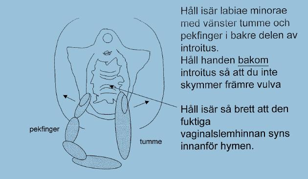 Gynekologisk undersökning yttre inspektion Hudförändringar? Eksem? Svullnad? Rodnad? Rivmärken? Vårtor? Blåsor?