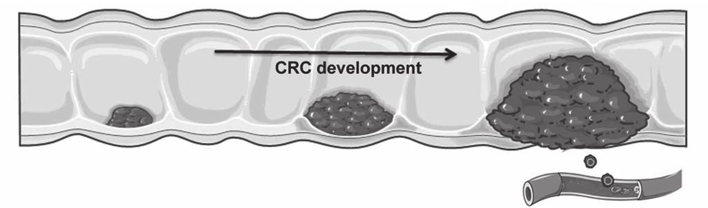Regulatory T cells and mucosal-associated invariant T cells in colon adenocarcinomas; Phenotype and function pathways regulating for example cellular proliferation and survival 25,26.