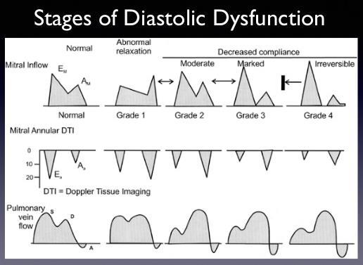 Diastolisk