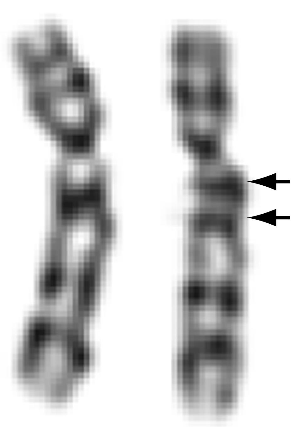 Gene$ska varianter varierar i storlek Normal varia4on Storleksordning (baspar) 10 6 A B 10