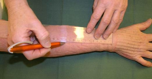 Beakta nagellängden) på dig III och markera 0- punkten i handledsnivå.