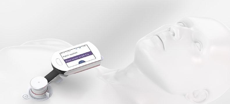 Acarix delårsrapport januari-mars CADScor Systemet kommer att förkorta väntelistor och generera mervärde för både patienter och vårdsektorn Dr.