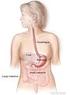 Quality of life after esophageal cancer surgery