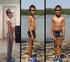 Barn med typ 1 diabetes. Children with type 1 diabetes