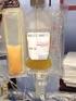 Higher safety in platelet transfusions using