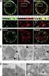 INTRACELLULAR DISTRIBUTION PATTERNS OF ORGANELL SPECIFIC PROTEINS USING IMMUNOHISTOCHEMICAL STAINING OF TISSUE MICRO ARRAYS.