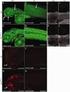Quantification of Tripeptidyl-peptidase II