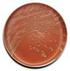 BD Chocolate Agar (GC II Agar with IsoVitaleX) BD Chocolate Agar (Blood Agar No. 2 Base)