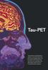Tau-PET. Alzheimer. Tau-nivåerna i cerebrospinalvätskan